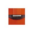 Ovation 6778-LX-5 Standard Elite Schwarz Thumbnail 4
