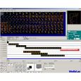 Medialas Laser Software Mamba Black + USB Interface Thumbnail 3