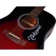 Takamine G320 Gloss Burgundy Burst Lim. Ed. Thumbnail 2