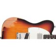 ESP Ltd TE-202 Distressed 3-TSB RW E-Gitarre Thumbnail 3