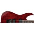 ESP Ltd M-300FM STBC E-Gitarre Thumbnail 3