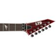 ESP Ltd M-300FM STBC E-Gitarre Thumbnail 4