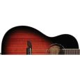 Alvarez AP66 SB Parlor Westerngitarre Thumbnail 4