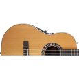 Ovation 1773AX-4 Nylon Natural Konzertgitarre Thumbnail 3