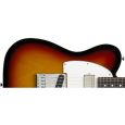 ESP Ltd RON WOOD BLK Signature E-Gitarre Thumbnail 3