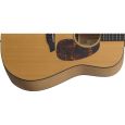 Furch D-20 CM E L.R. Baggs Anthem Westerngitarre Thumbnail 3