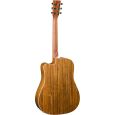 Martin Guitars DCRSG Westerngitarre Thumbnail 2