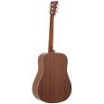 VGS Acoustic Selection Mistral Westerngitarren Set B-Ware Thumbnail 3