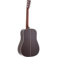 Martin Guitars HD-28 Adirondack Custom Westerngitarre Thumbnail 2