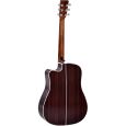 Sigma DTC-1E-SB Dreadnought Westerngitarre Thumbnail 2